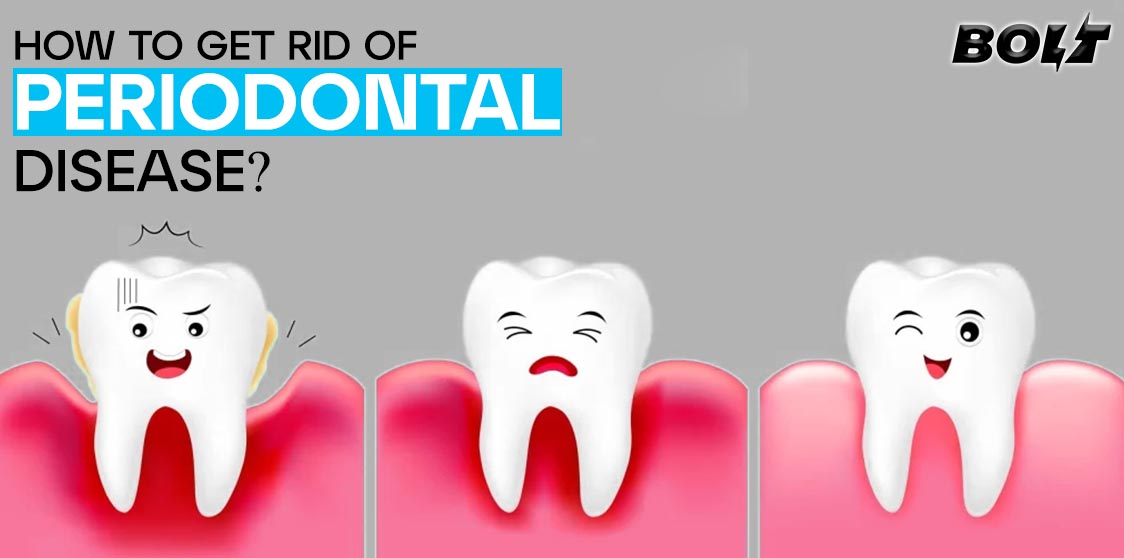 How to Get Rid of Periodontal Disease